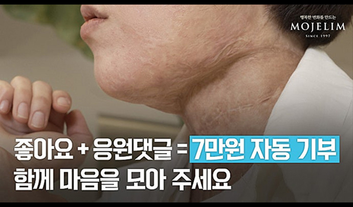 患者様のストーリー